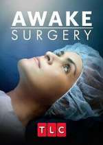 S1 E3 Awake Surgery Season 1 Episode 3